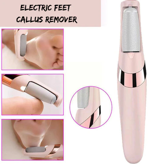 Soly Skin™ Electric Feel Callus Remover